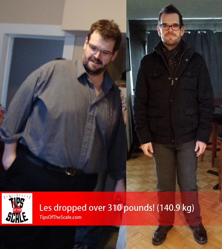 Les Stratford Before & After