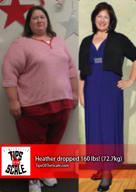 Heather Gum Before & After Photo