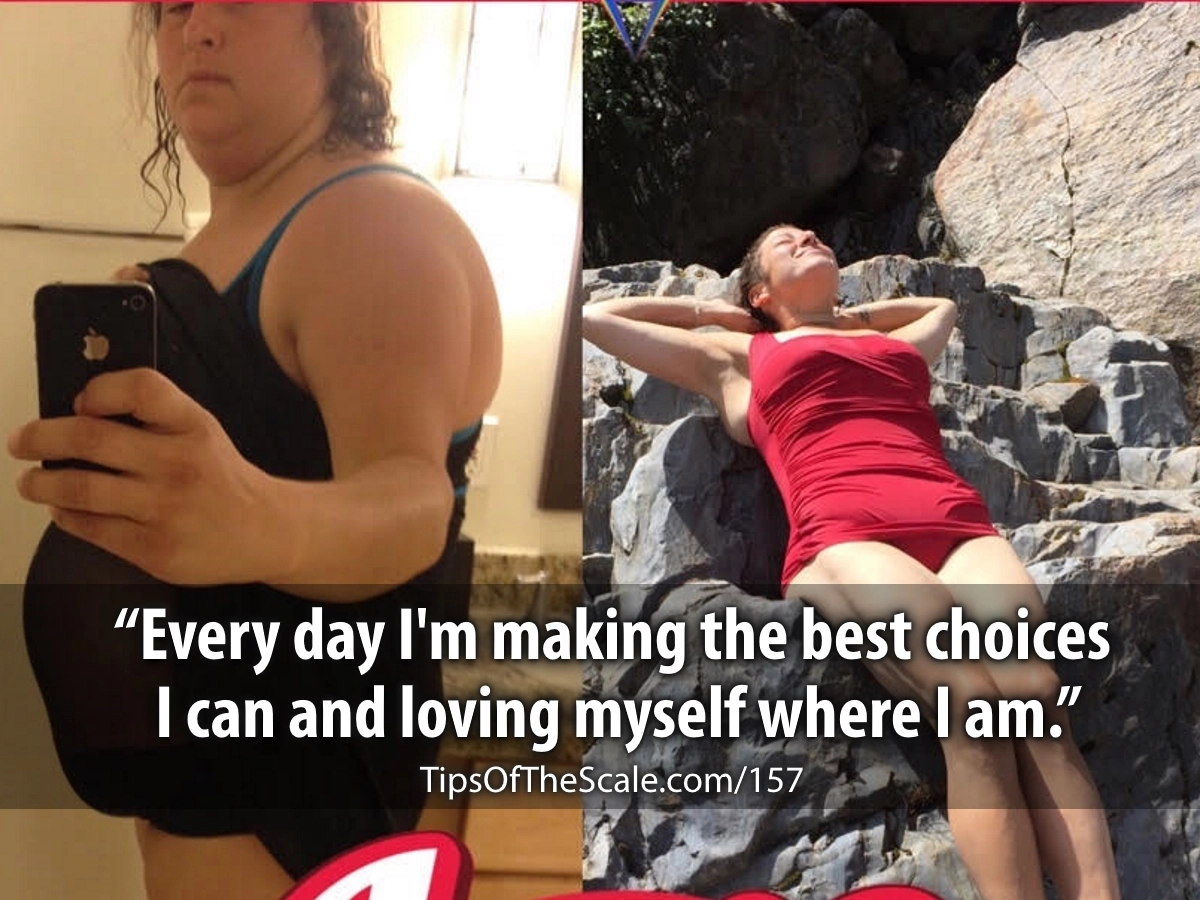 Sara Kaplan Before/After